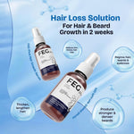Beard & Hair Growth Serum 50ml — Minoxidil 5% | Rosemary Extract | Redensyl | Thicker Fuller Hair