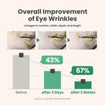 AXIS-Y Vegan Collagen Eye Serum 10ml — Dark Circles | Puffiness | Wrinkles | CoolTouch Applicator