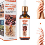 Dark Knuckle Whitening Serum — Niacinamide & Allantoin | Safe for All Skin | Body Brightening