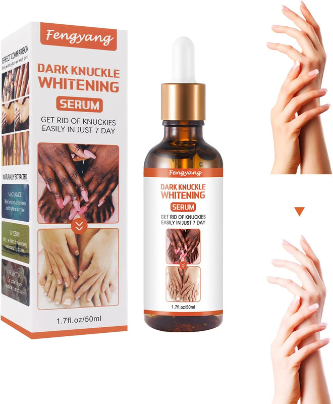 Dark Knuckle Whitening Serum — Niacinamide & Allantoin | Safe for All Skin | Body Brightening