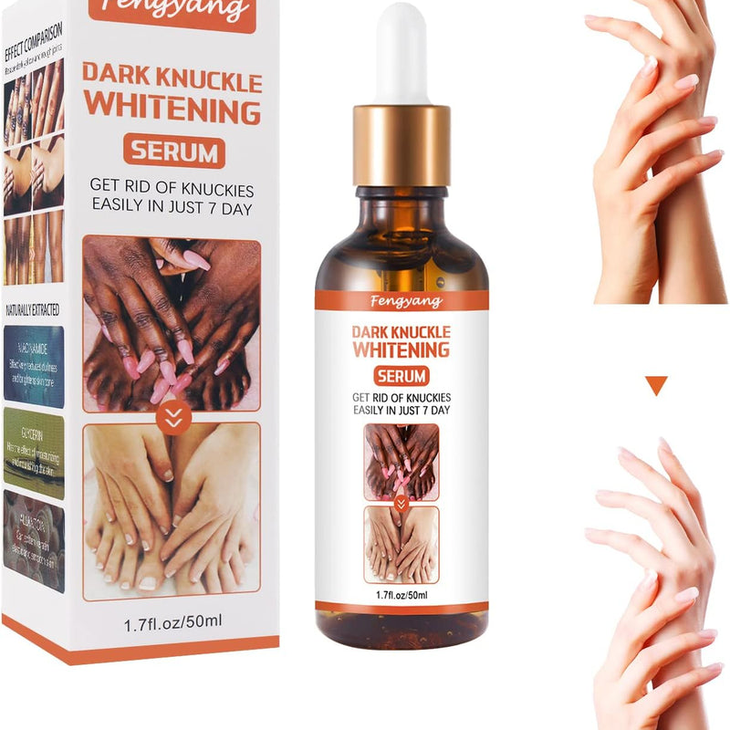 Dark Knuckle Whitening Serum — Niacinamide & Allantoin | Safe for All Skin | Body Brightening